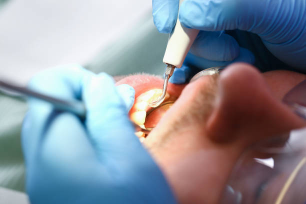 Best Same-Day Emergency Dental Services in Garrett, TX