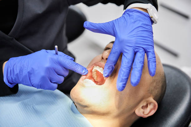 Best Emergency Wisdom Teeth Removal in Garrett, TX