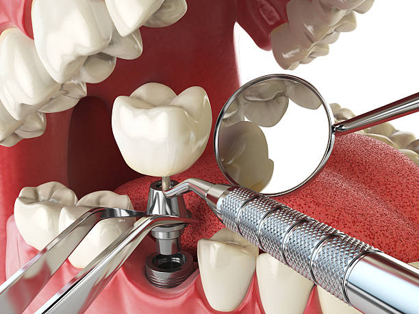 Best Emergency TMJ Treatment in Garrett, TX