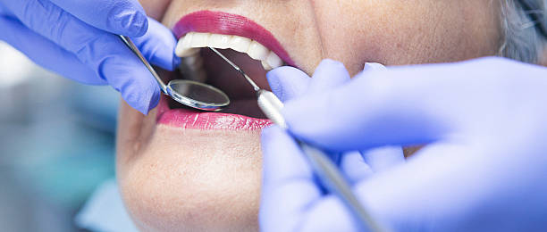 Best Emergency Tooth Extraction in Garrett, TX