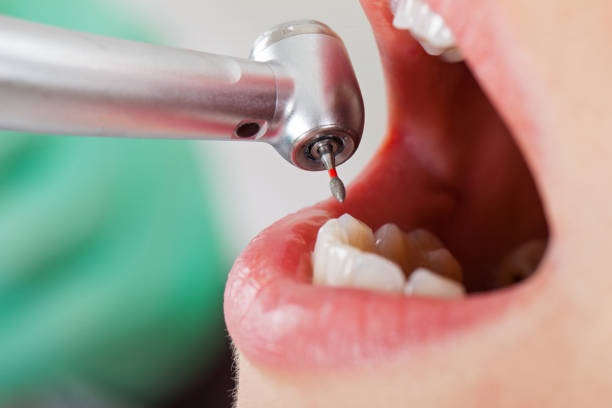Best Emergency Gum Treatment in Garrett, TX